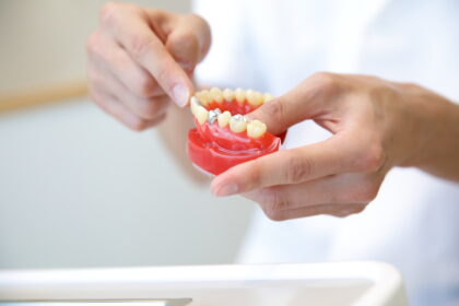 ste6. 汚れの状況によってセルフケアのアドバイス