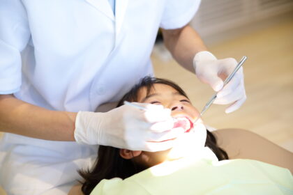 step2. 口腔内のチェック