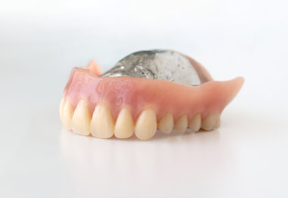 金属床義歯