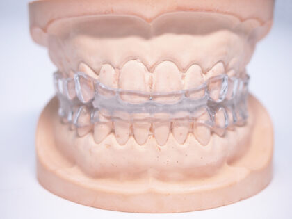 スリープスプリント療法