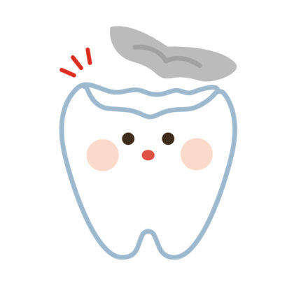 詰め物・被せ物とは